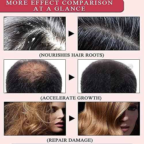 Saç Bakımı Saç Büyüme Uçucu Yağlar, Zencefil Saç Serum Özü Yağı, Zencefil uçucu yağ Durdurma Saç Dökülmesi Saç, İnceltme Tedavisi